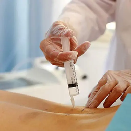 tratamiento con ozono - ozonoterapia